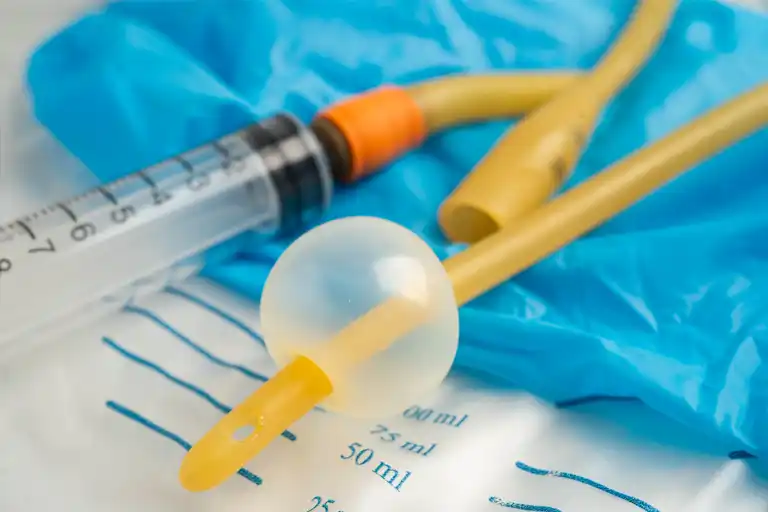 Indwelling (Foley catheter